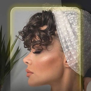 Rhinoplasty-4