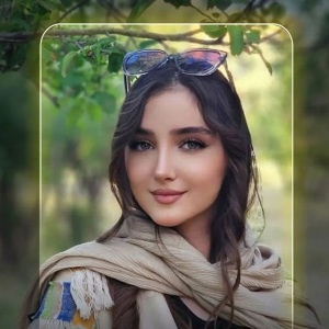 Rhinoplasty-5