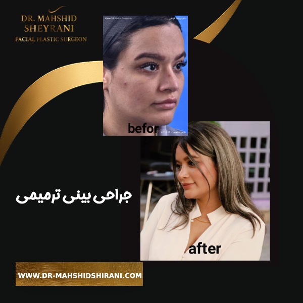 جراحی بینی ترمیمی