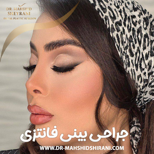 جراحی بینی فانتزی در تهران + دکتر مهشید شیرانی