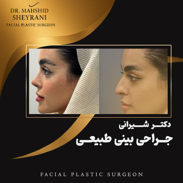 جراحی بینی طبیعی