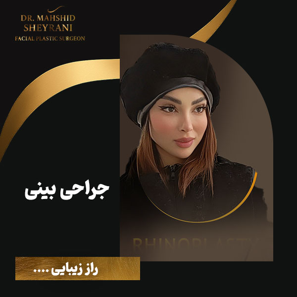 نمونه کار جراحی بینی