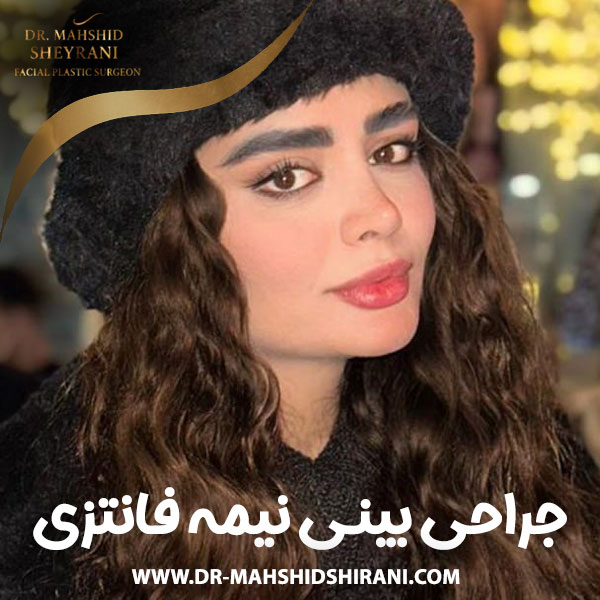 جراحی بینی نیمه فانتزی + دکتر مهشید شیرانی