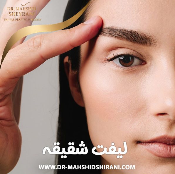 لیفت شقیقه در تهران | دکتر مهشید شیرانی