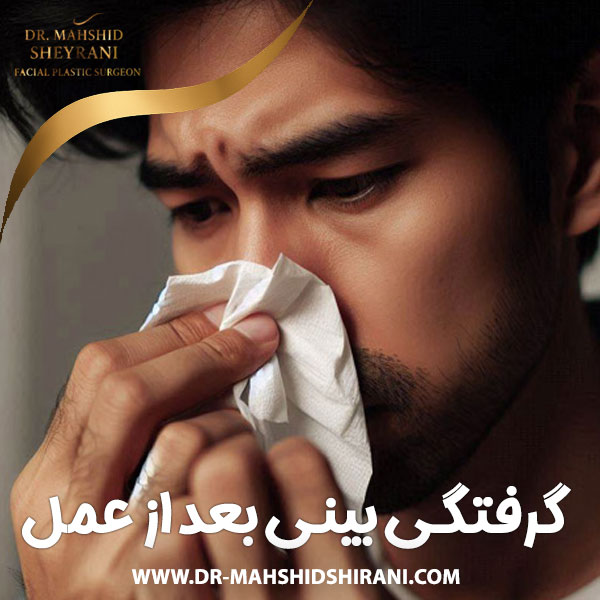 گرفتگی بینی بعد از عمل + دکتر مهشید شیرانی